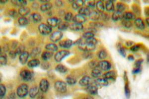 Image no. 1 for anti-Prostate Specific Antigen (PSA) antibody (ABIN271793) (Prostate Specific Antigen anticorps)