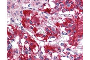Immunohistochemistry (IHC) image for anti-Glutamate Decarboxylase 1 (Brain, 67kDa) (GAD1) (N-Term) antibody (ABIN785685) (GAD anticorps  (N-Term))