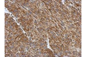 anti-Ribosomal Protein S3A (RPS3A) (AA 1-264) antibody