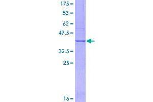 Image no. 1 for Tumor Necrosis Factor Receptor Superfamily, Member 21 (TNFRSF21) (AA 1-124) protein (GST tag) (ABIN1323189)
