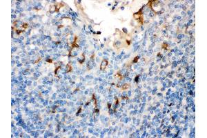 Filaggrin was detected in paraffin-embedded sections of human Tonsil tissues using rabbit anti- Filaggrin Antigen Affinity purified polyclonal antibody at 1 μg/mL. (Filaggrin anticorps  (AA 1-261))