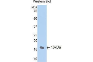 Western blot analysis of the recombinant protein. (CUBN anticorps  (AA 3157-3274))