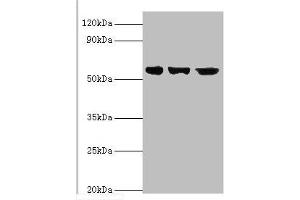 Western blot All lanes: Bardet-Biedl syndrome 4 protein antibody at 4 μg/mL Lane 1: Hela whole cell lysate Lane 2: U251 whole cell lysate Lane 2: Mouse heart tissue Secondary Goat polyclonal to rabbit IgG at 1/10000 dilution Predicted band size: 59, 60, 39 kDa Observed band size: 59 kDa (BBS4 anticorps  (AA 350-519))