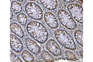 IHC analysis of hnRNP U/p120/HNRNPU using anti-hnRNP U/p120/HNRNPU antibody (ABIN7600979).