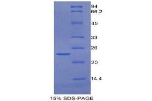 SDS-PAGE (SDS) image for Growth Arrest-Specific 6 (GAS6) (AA 136-311) protein (His tag) (ABIN1877864)