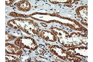 Immunohistochemical staining of paraffin-embedded Human Kidney tissue using anti-LMAN1 mouse monoclonal antibody. (LMAN1 anticorps)