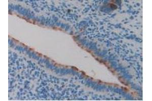 IHC-P analysis of Mouse Uterus Tissue, with DAB staining. (Clusterin anticorps  (AA 227-447))