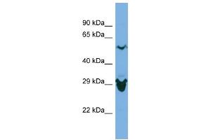 Host:  Rabbit  Target Name:  SEPHS2  Sample Type:  ACHN Whole Cell lysates  Antibody Dilution:  1.