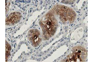 Immunohistochemical staining of paraffin-embedded Human Kidney tissue using anti-ALDOB mouse monoclonal antibody. (ALDOB anticorps)