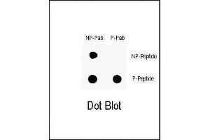 Dot blot analysis of anti-Phospho-ABL1- Antibody (ABIN6241067 and ABIN6578924) on nitrocellulose membrane.