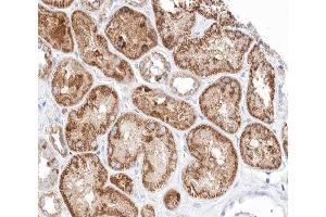 ABIN6266616 at 1/100 staining human kidney tissue sections by IHC-P. (Patched 1 anticorps  (N-Term))