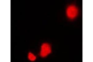 Immunofluorescent analysis of STIP1 staining in Hela cells.