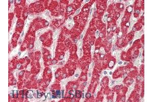 IHC-P analysis of Human Liver Tissue, with HE staining. (GBA anticorps  (AA 117-214))