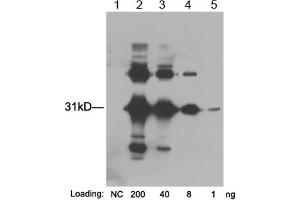 Lane 1: Negative E. (GST-Tag anticorps  (Biotin))