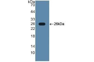Detection of Recombinant TLR2, Human using Polyclonal Antibody to Toll Like Receptor 2 (TLR2) (TLR2 anticorps  (AA 644-784))