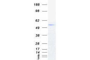 Validation with Western Blot