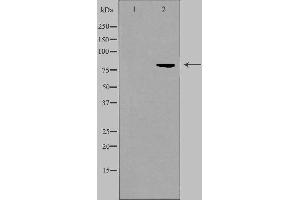 Western blot analysis of extracts from HuvEc cells, using ALS2CR8 antibody. (CDKN2AIP anticorps  (Internal Region))