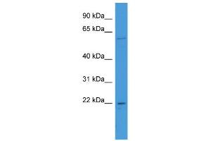 WB Suggested Anti-FATE1 Antibody Titration: 0. (FATE1 anticorps  (N-Term))