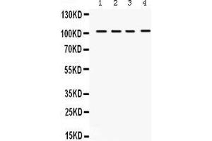 Western Blotting (WB) image for anti-Histone Deacetylase 7 (HDAC7) (AA 68-103), (N-Term) antibody (ABIN3042441) (HDAC7 anticorps  (N-Term))