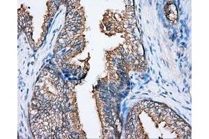 Immunohistochemical staining of paraffin-embedded Kidney tissue using anti-BTK mouse monoclonal antibody. (BTK anticorps)