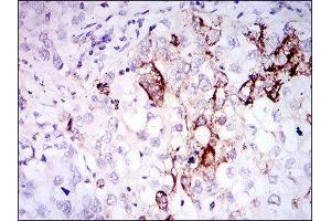Immunohistochemistry (IHC) image for anti-Somatostatin (SST) (AA 1-116) antibody (ABIN1845358) (Somatostatin anticorps  (AA 1-116))