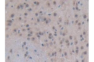 Detection of EP300 in Mouse Brain Tissue using Polyclonal Antibody to E1A Binding Protein P300 (EP300)