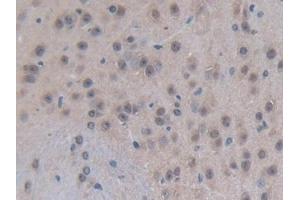Detection of EP300 in Mouse Brain Tissue using Polyclonal Antibody to E1A Binding Protein P300 (EP300) (p300 anticorps  (AA 2124-2397))