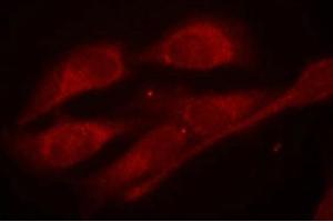 Immunofluorescence staining of methanol-fixed Hela cells using Shc1(Phospho-Tyr427) Antibody. (SHC1 anticorps  (pTyr427))