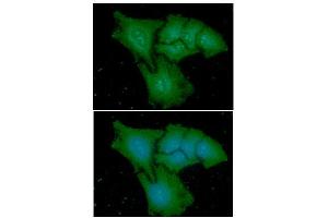 ICC/IF analysis of CAPG in HeLa cells line, stained with DAPI (Blue) for nucleus staining and monoclonal anti-human CAPG antibody (1:100) with goat anti-mouse IgG-Alexa fluor 488 conjugate (Green).