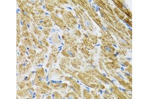 Immunohistochemistry of paraffin-embedded Rat heart using POLG2 Polyclonal Antibody at dilution of 1:100 (40x lens). (POLG2 anticorps)