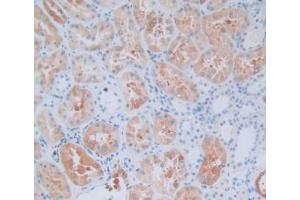 IHC-P analysis of Human Kidney Tissue, with DAB staining. (CRYAB anticorps  (AA 1-175))