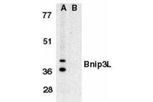 Western blot analysis of Bnip3L in K562 whole cell lysate in the absence (A), or presence (B) of immunogenic peptide with Bnip3L antibody at 1μg/ml.