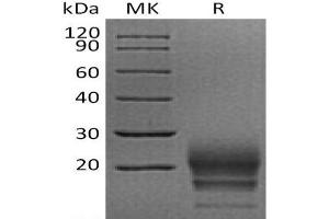 Western Blotting (WB) image for CD160 (CD160) protein (His tag) (ABIN7321006) (CD160 Protein (CD160) (His tag))