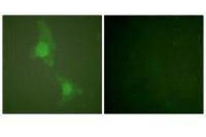 Immunofluorescence analysis of HeLa cells, using ADD1 (Ab-726) antibody (alpha Adducin anticorps  (Ser726))