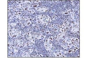 IHC analysis of Serum Response Factor/SRF using anti-Serum Response Factor/SRF antibody (ABIN7600213).