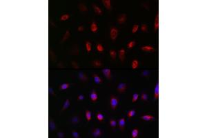 Immunofluorescence analysis of U-251MG cells using GNB3 Rabbit pAb (ABIN1680055, ABIN3015467, ABIN3015468 and ABIN6218020) at dilution of 1:50 (40x lens). (GNB3 anticorps  (AA 1-230))