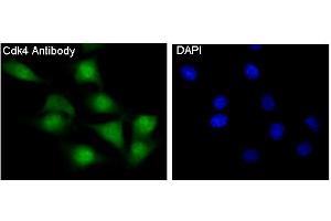 Immunofluorescent analysis of NIH/3T3 cells, using CDK4 Antibody.