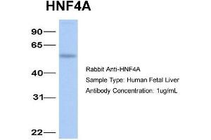 WB Suggested Anti-HNF4A antibody Titration: 1 ug/mL Sample Type: Human Liver