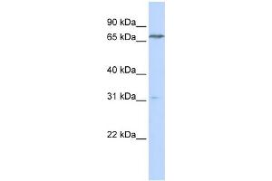 WB Suggested Anti-PCCA Antibody Titration:  0. (PCCA anticorps  (N-Term))