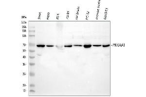 Western blot analysis of AMPK alpha 1 using anti-AMPK alpha 1 antibody (ABIN5693057).