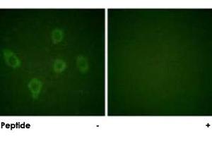 Immunofluorescence analysis of HUVEC cells, using CASP9 polyclonal antibody . (Caspase 9 anticorps)