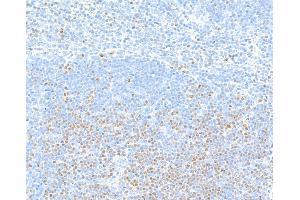 Immunohistochemistry (IHC) image for anti-Transcription Factor 7 (T-Cell Specific, HMG-Box) (TCF7) (AA 200-250) antibody (ABIN7449420) (Recombinant TCF7 anticorps  (AA 200-250))