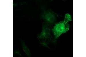 Immunofluorescence (IF) image for anti-Tubulin beta 4a (TUBB4A) antibody (ABIN1501580)