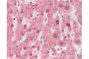 Human, Liver: Formalin-Fixed Paraffin-Embedded (FFPE).