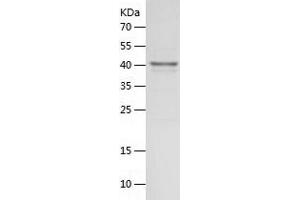 Western Blotting (WB) image for 2',5'-Oligoadenylate Synthetase 1, 40/46kDa (OAS1) (AA 1-364) protein (His tag) (ABIN7121603)