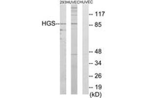 Western blot analysis of extracts from 293/HuvEc cells, using HGS Antibody. (HGS anticorps  (AA 451-500))