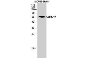 Western Blotting (WB) image for anti-Cytochrome P450, Family 2, Subfamily C, Polypeptide 19 (CYP2C19) (Internal Region) antibody (ABIN6282222)