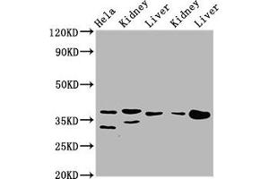 Western Blot Positive WB detected in: Hela whole cell lysate, Rat kidney tissue, Rat liver tissue, Mouse kidney tissue, Mouse liver tissue All lanes: PPA2 antibody at 3. (PPA2 anticorps  (AA 180-298))