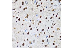 Immunohistochemistry of paraffin-embedded rat brain using CCAR2 antibody (ABIN2563550) at dilution of 1:100 (40x lens). (CCAR2 anticorps)