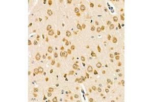 Immunohistochemistry of paraffin embedded mouse brain using Rac3 (ABIN7075378) at dilution of 1:2000 (400x lens)
